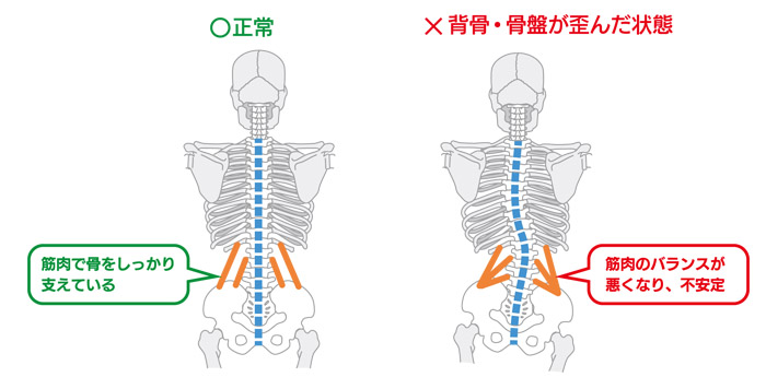 腰の痛み・ぎっくり腰は、放置せず早期治療が大切です